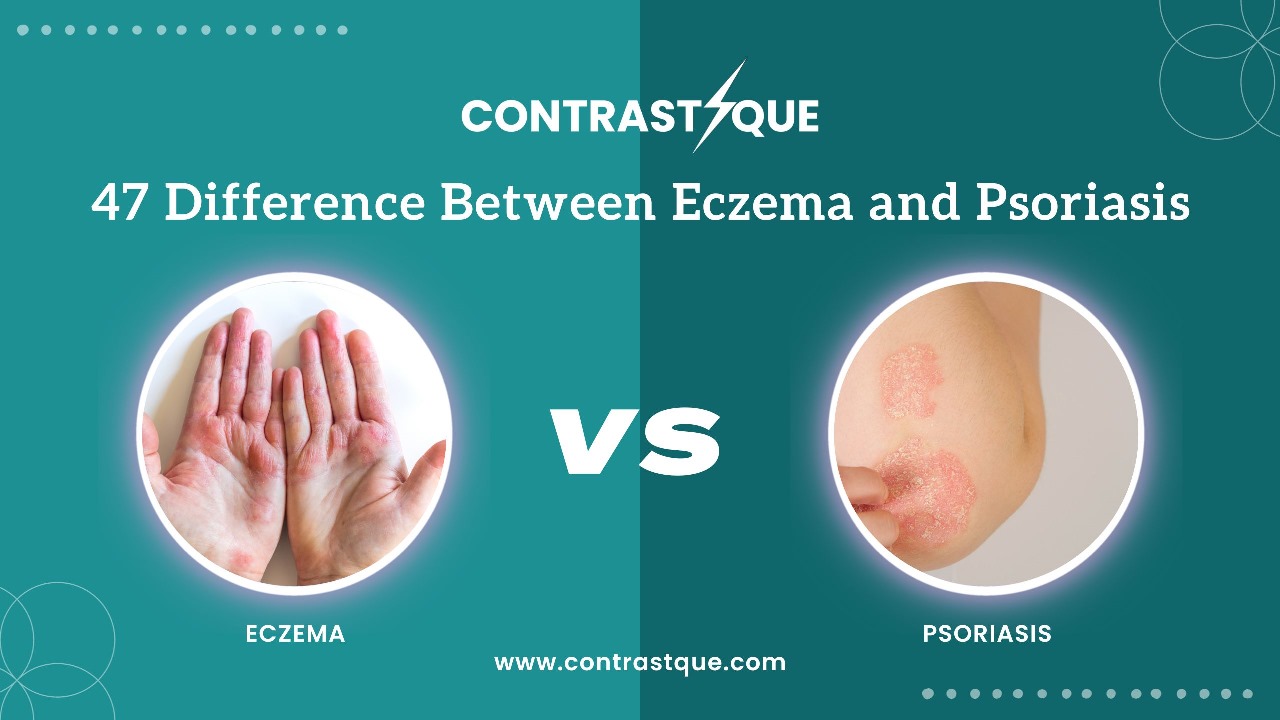 47 Difference Between Eczema and Psoriasis
