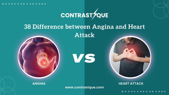 38 Difference between Angina and Heart Attack